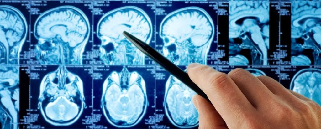 Brain Foundation - Brain scan - Salesforce